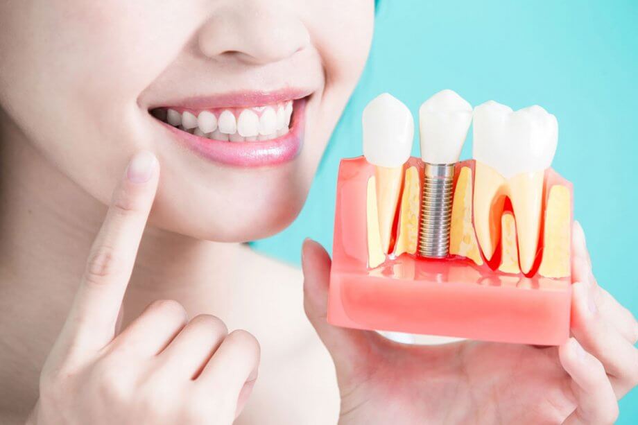 Dental Implant in Ulhasnagar